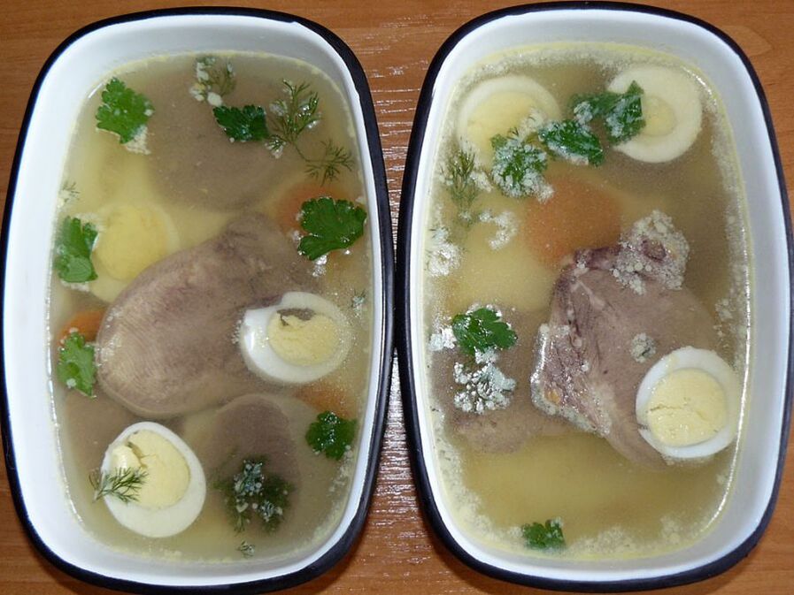 آسپیک برای آرتروز زانو